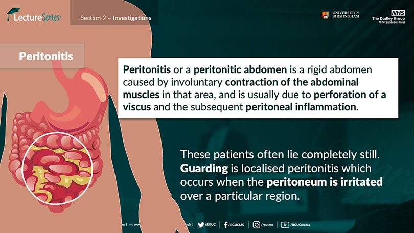 Acute abdomen lecture screenshot from Peritonitis module