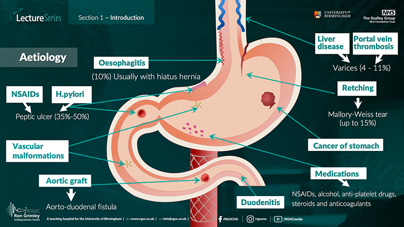 Upper GI bleed lecture screenshot from the Aetiology module